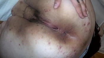 cellulite ass spreading close up buttholes
